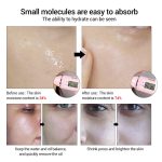 سرم هیالرونیک اسید لانبنا