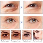 پچ طلا دور چشم وان اسپرینگ