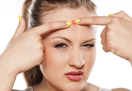 بهترین روش برای تخلیه جوش های سرسیاه