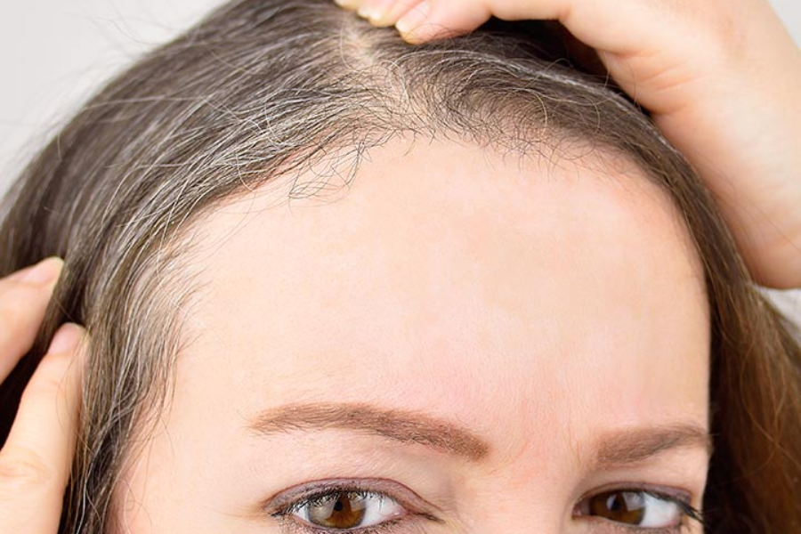 درمان خانگی سفیدی مو