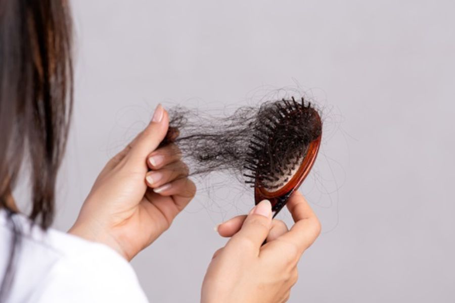 جلوگیری از ریزش مو در زنان و مردان 