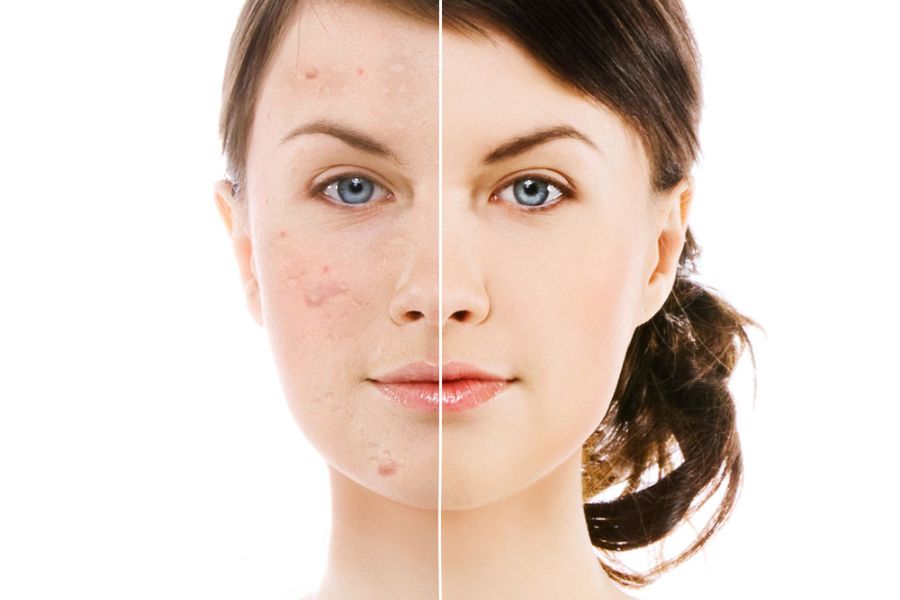 10 اشتباه رایج در مراقبت از پوست